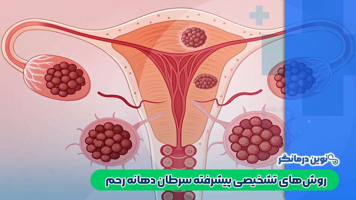 روش‌های تشخیصی پیشرفته سرطان دهانه رحم