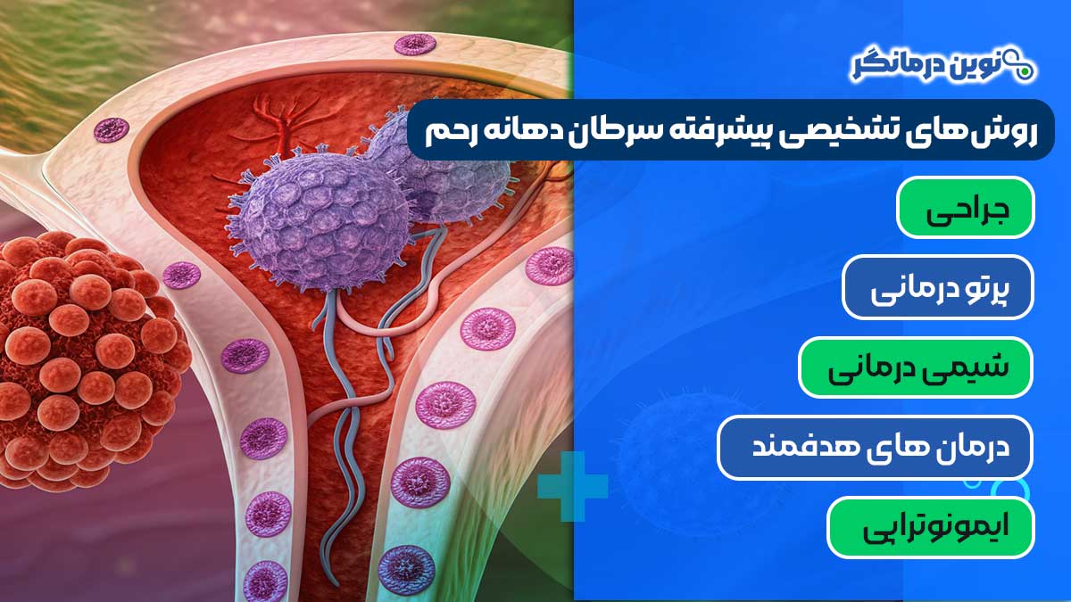 روش‌ های درمانی سرطان دهانه رحم