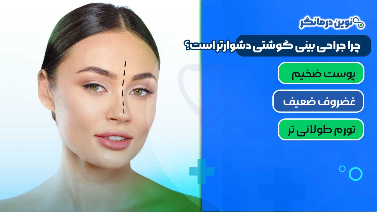چرا جراحی بینی گوشتی دشوارتر است؟