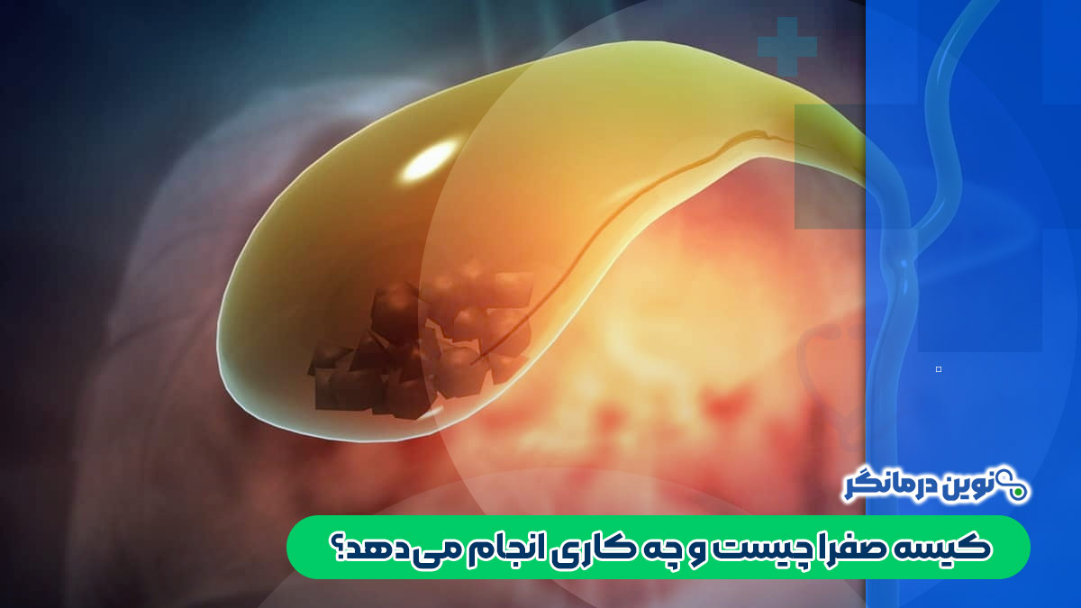کیسه صفرا چیست و چه کاری انجام می‌دهد؟