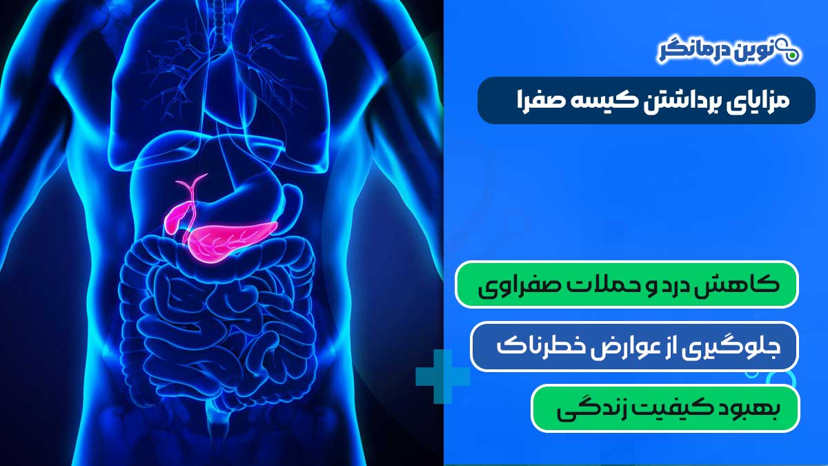 مزایای برداشتن کیسه صفرا