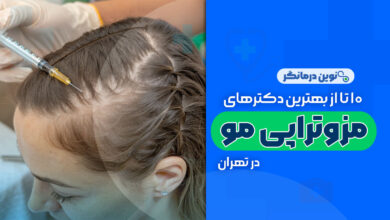 10 تا از بهترین دکترهای مزوتراپی مو در تهران