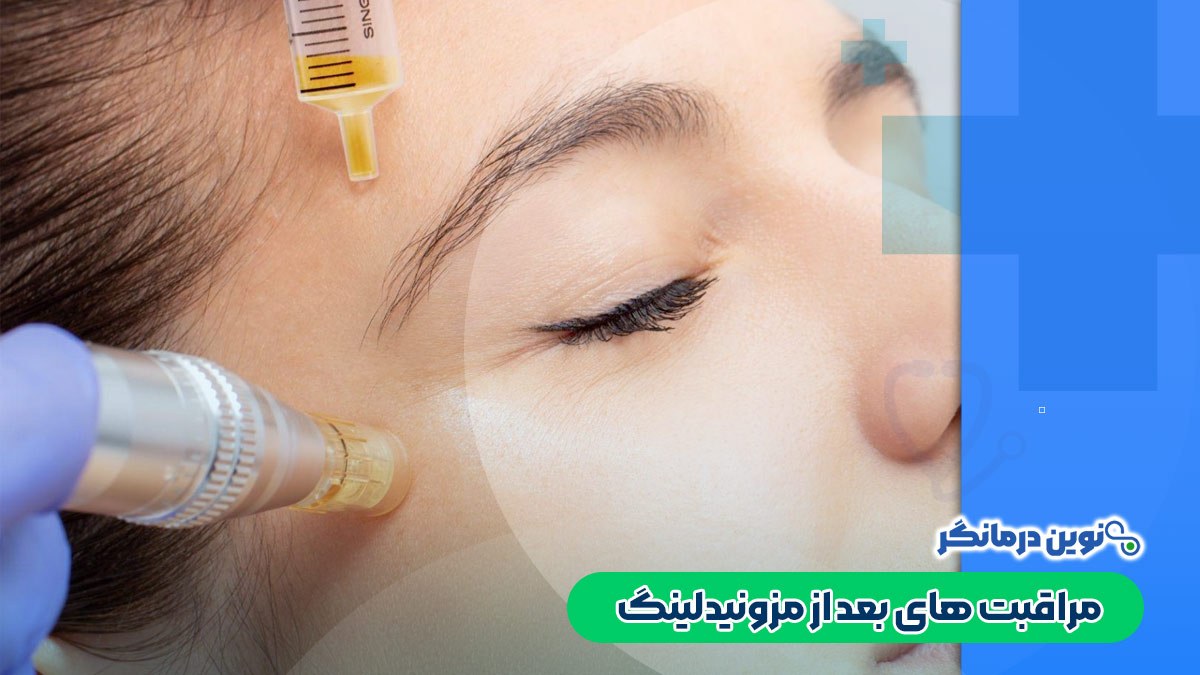 مراقبت های بعد از مزونیدلینگ