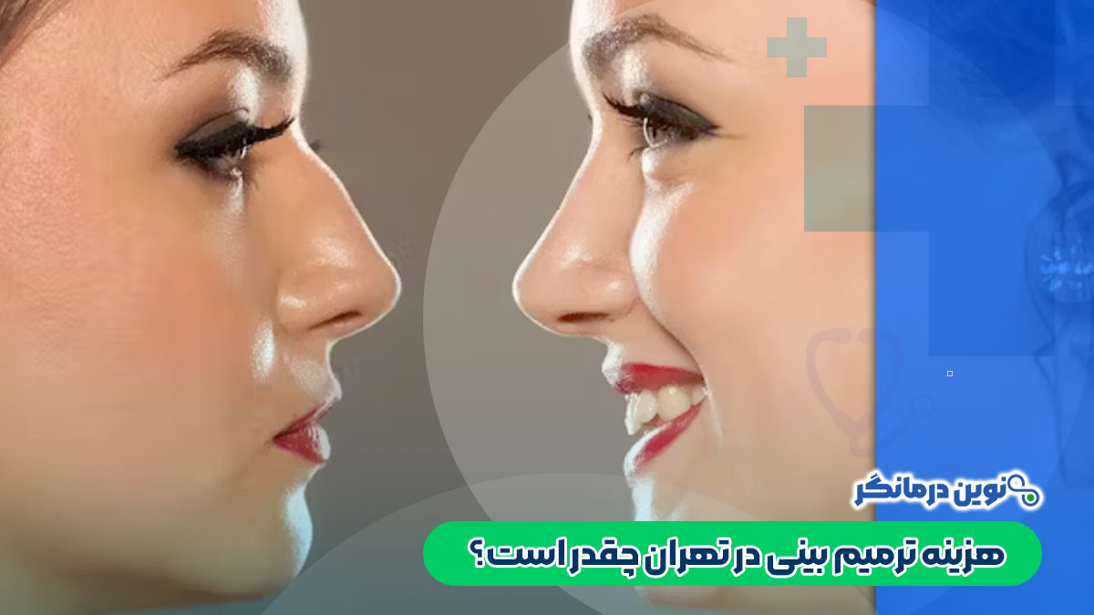 هزینه ترمیم بینی در تهران چقدر است؟