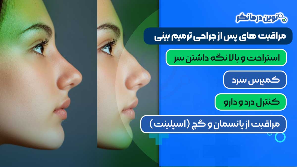 مراقبت‌ های پس از جراحی ترمیم بینی