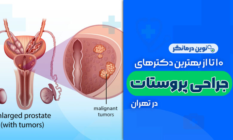 10 تا از بهترین دکترهای جراحی پروستات در تهران