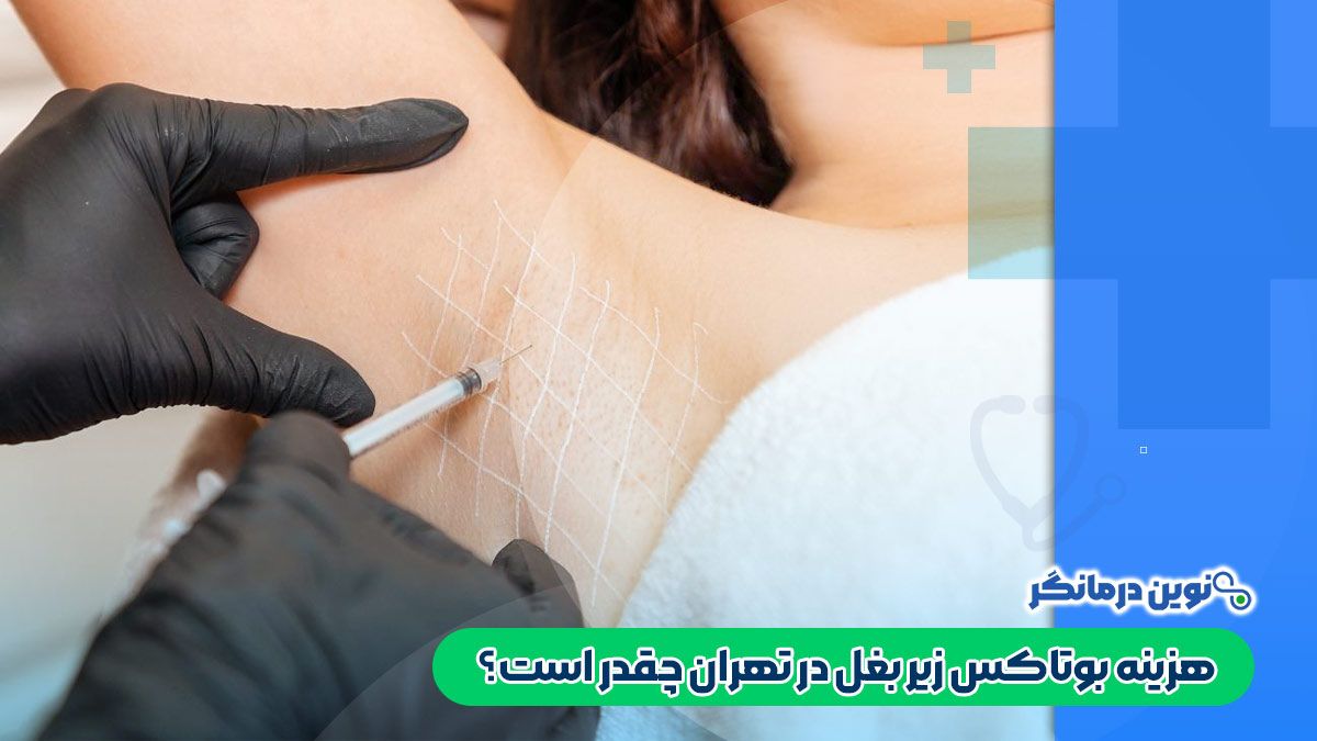 هزینه بوتاکس زیر بغل در تهران چقدر است؟