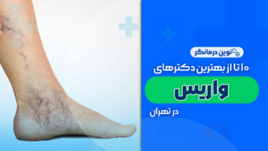 10 تا از بهترین دکترهای واریس در تهران