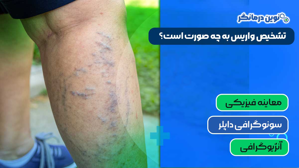 تشخیص واریس به چه صورت است؟