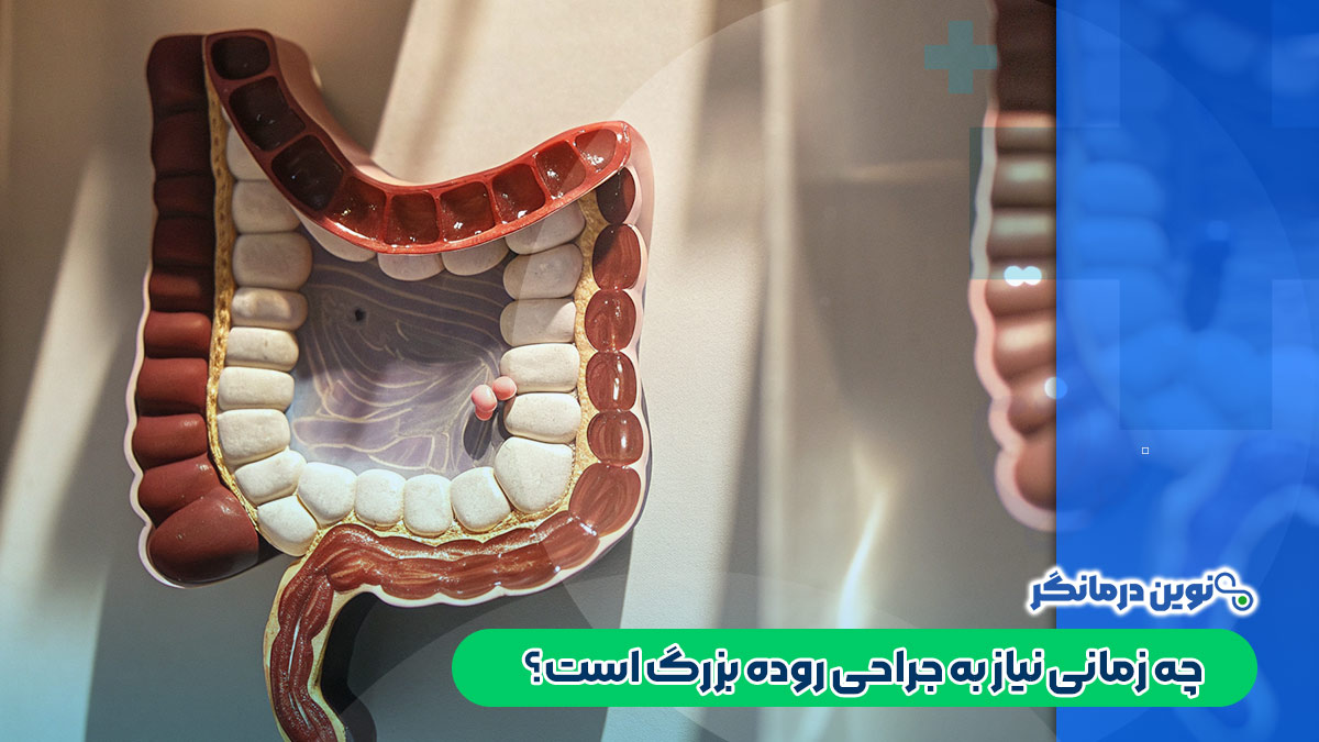 چه زمانی نیاز به جراحی روده بزرگ است؟