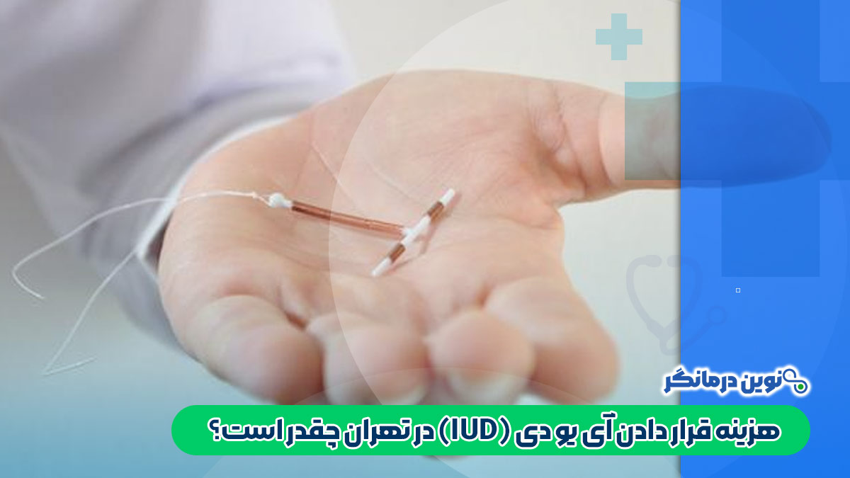 هزینه قرار دادن آی یو دی (IUD) در تهران چقدر است؟