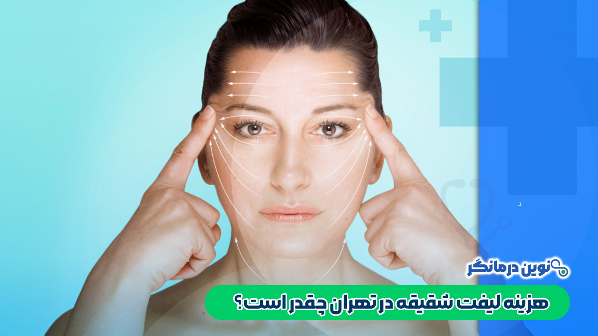 هزینه لیفت شقیقه در تهران چقدر است؟