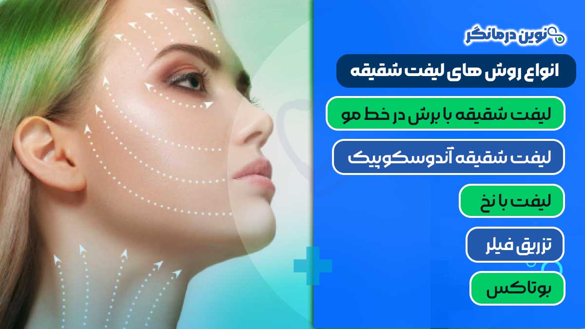 انواع روش‌ های لیفت شقیقه