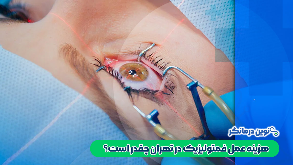 هزینه عمل فمتولیزیک در تهران چقدر است؟