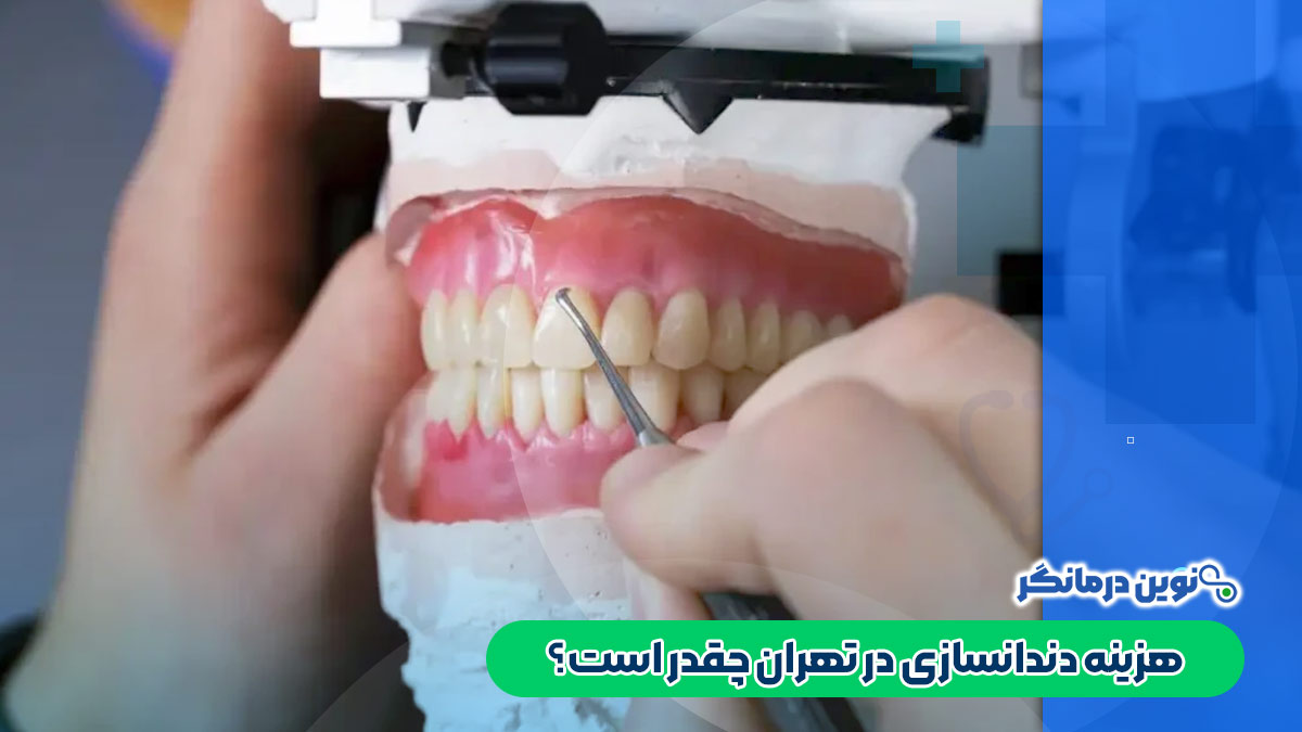 هزینه دندانسازی در تهران چقدر است؟