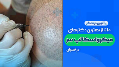 10 تا از بهترین مراکز میکرواسکالپ سر در تهران