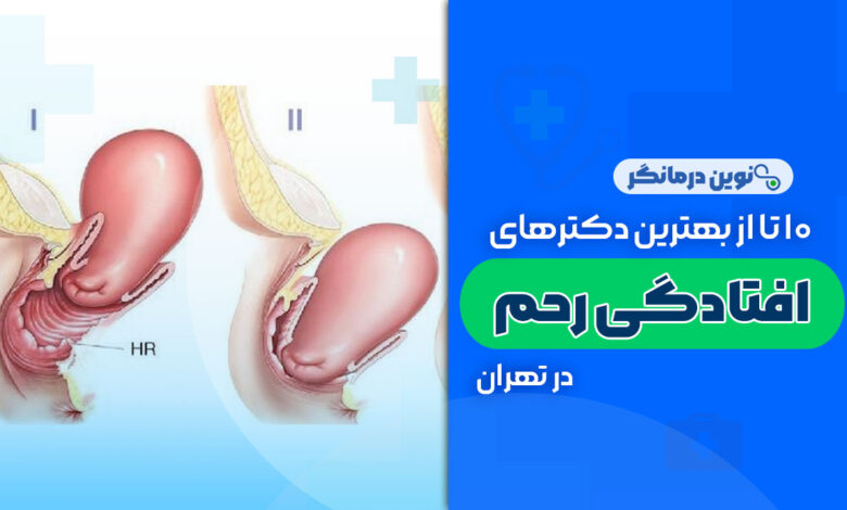 10 تا از بهترین دکترهای افتادگی رحم در تهران