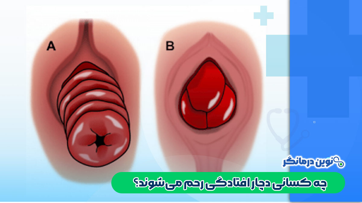 چه کسانی دچار افتادگی رحم می‌شوند؟