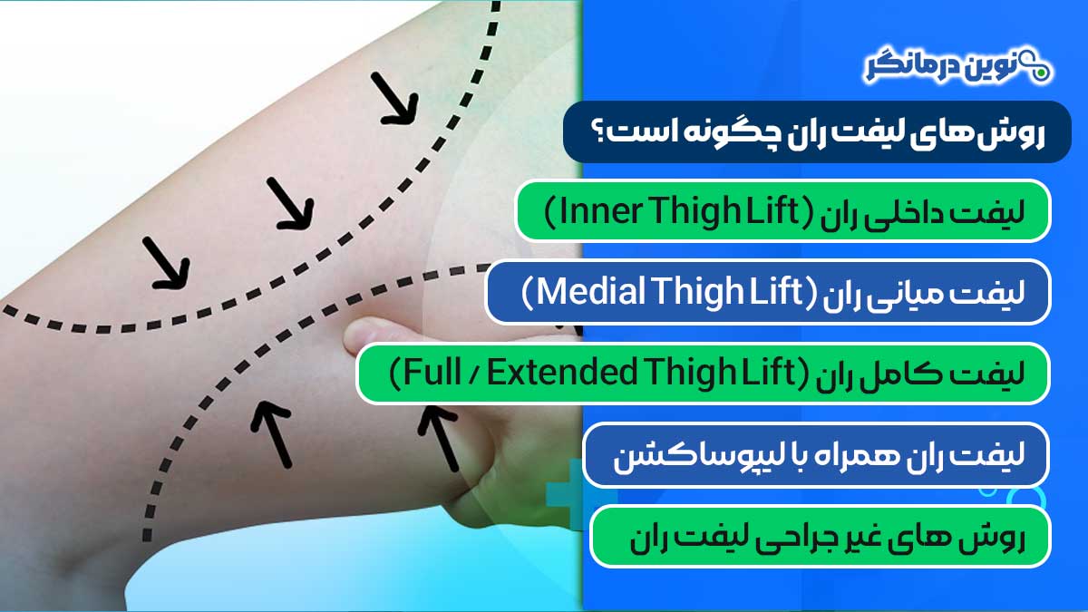 روش‌های لیفت ران چگونه است؟