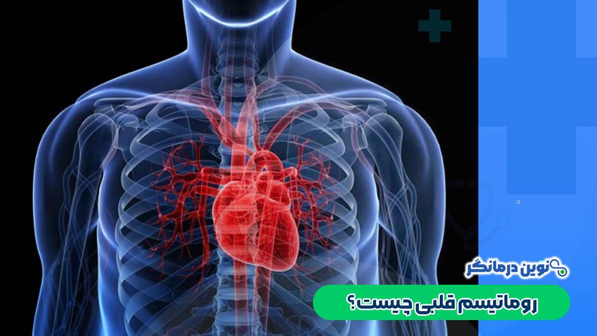 روماتیسم قلبی چیست؟