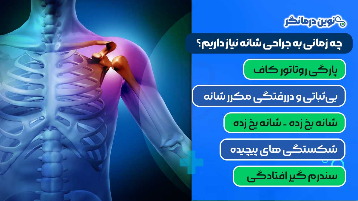 چه زمانی به جراحی شانه نیاز داریم؟