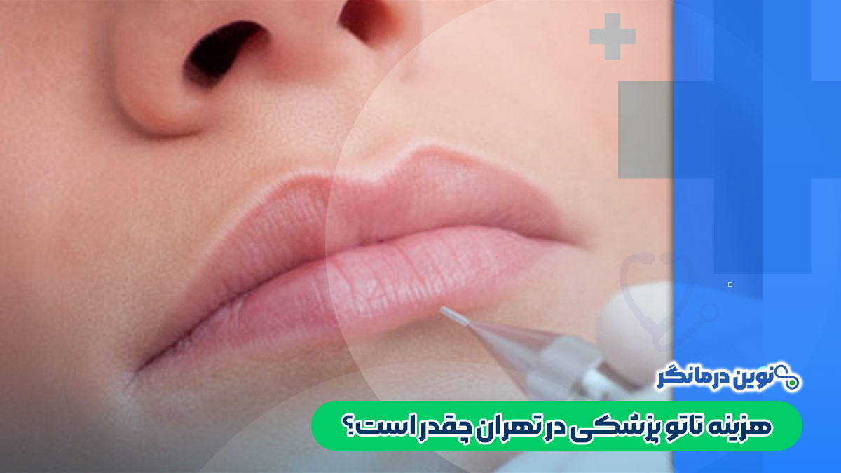 هزینه تاتو پزشکی در تهران چقدر است؟