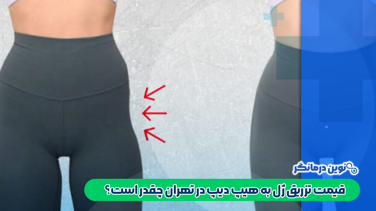 قیمت تزریق ژل به هیپ دیپ در تهران چقدر است؟