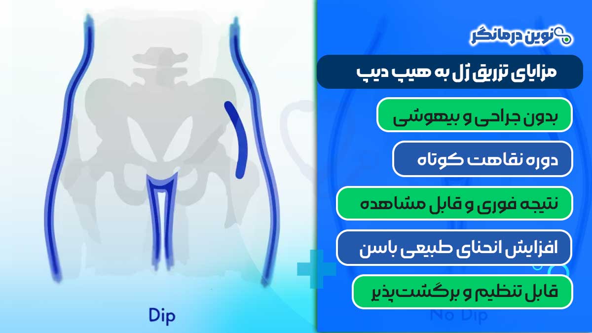 مزایای تزریق ژل به هیپ دیپ