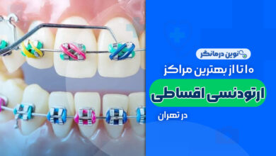10 تا از بهترین مراکز ارتودنسی اقساطی در تهران