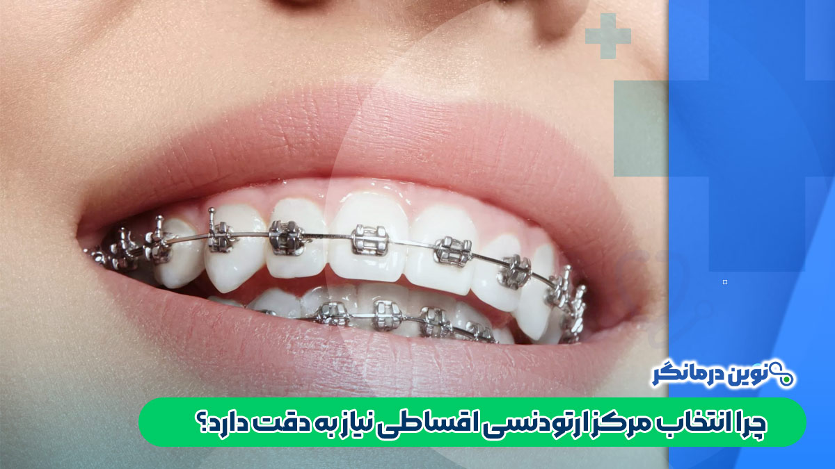 چرا انتخاب مرکز ارتودنسی اقساطی نیاز به دقت دارد؟