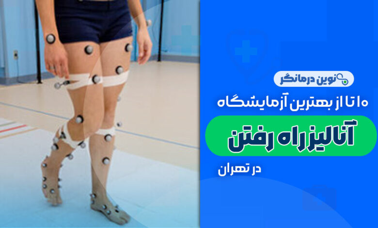 10 تا از بهترین آزمایشگاه آنالیز راه رفتن در تهران