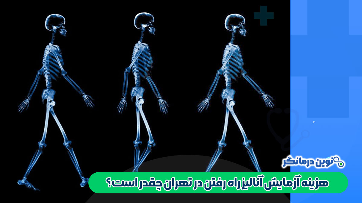 هزینه آزمایش آنالیز راه رفتن در تهران چقدر است؟