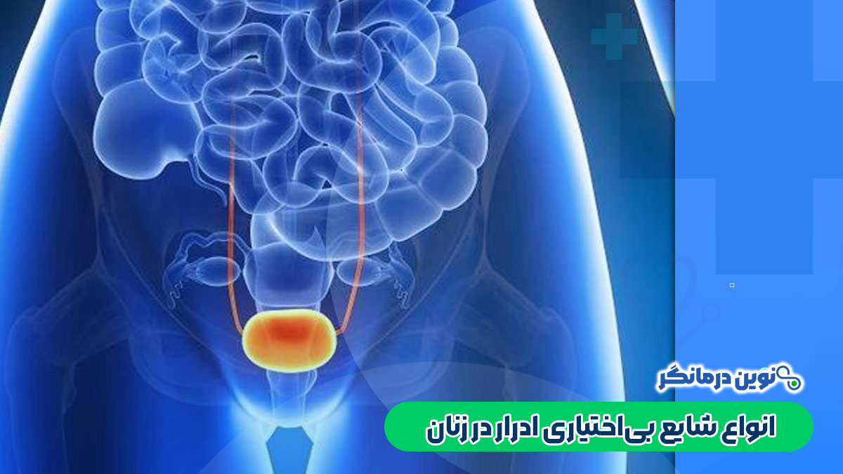 انواع شایع بی‌اختیاری ادرار در زنان