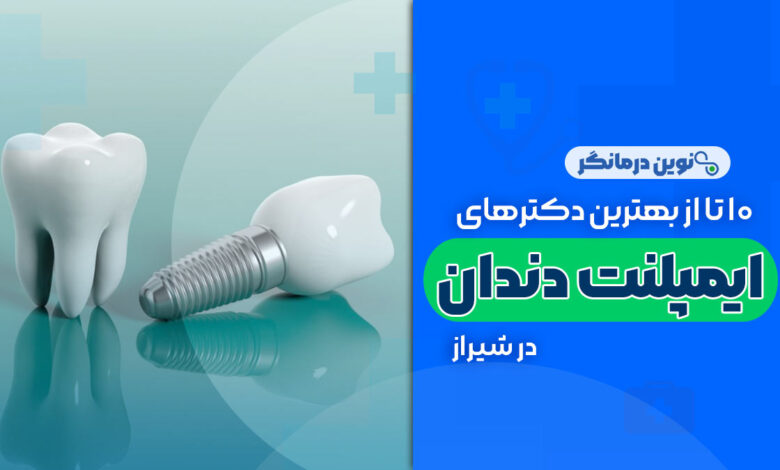 10 تا از بهترین دکترهای متخصص ایمپلنت در شیراز