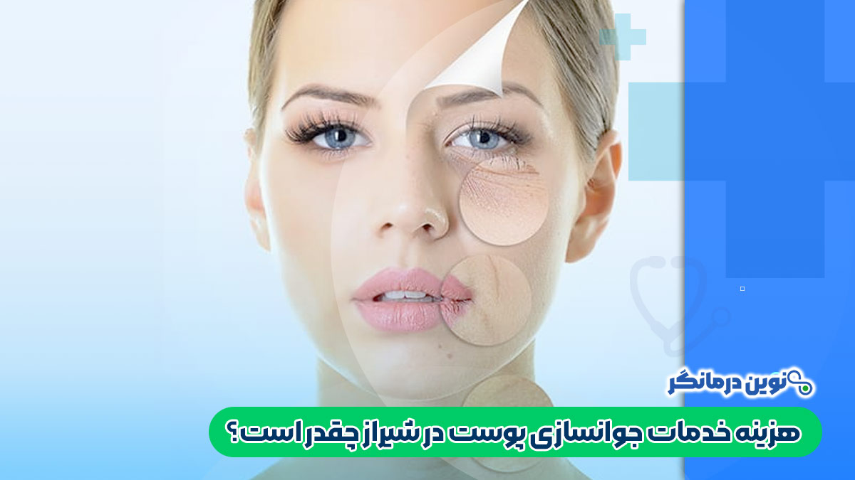 هزینه خدمات جوانسازی پوست در شیراز چقدر است؟
