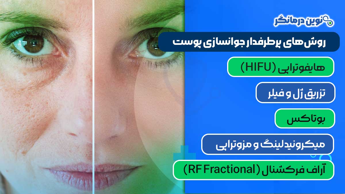 روش‌های پرطرفدار جوانسازی پوست در کلینیک‌های شیراز