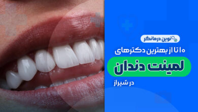 10 تا از بهترین دکترهای لمینت دندان در شیراز