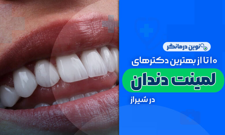 10 تا از بهترین دکترهای لمینت دندان در شیراز