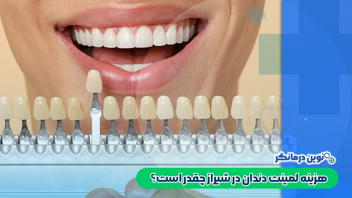 هزینه لمینت دندان در شیراز چقدر است؟