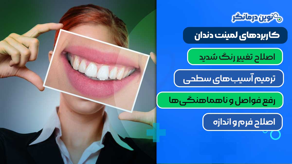 کاربردهای لمینت دندان
