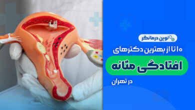 10 تا از بهترین دکترهای افتادگی مثانه در تهران
