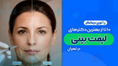 10 تا از بهترین دکترهای لیفت بینی در تهران