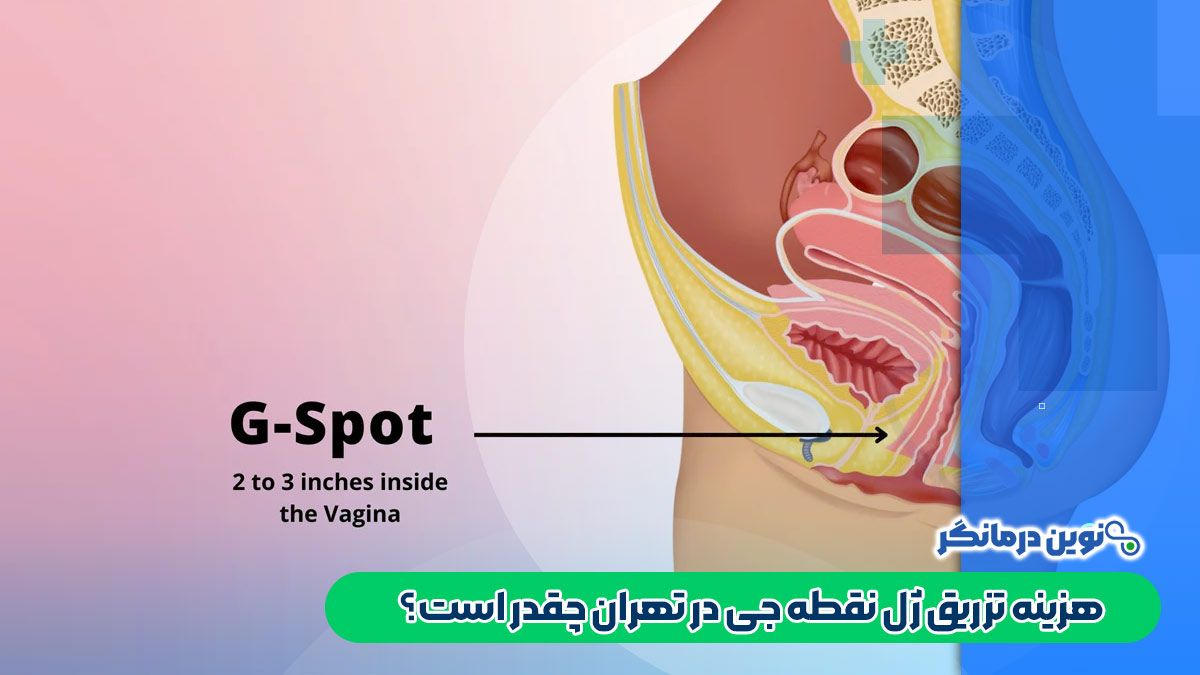 هزینه تزریق ژل نقطه جی در تهران چقدر است؟