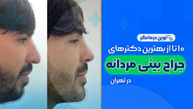 10 تا از بهترین دکترهای جراح بینی مردانه در تهران