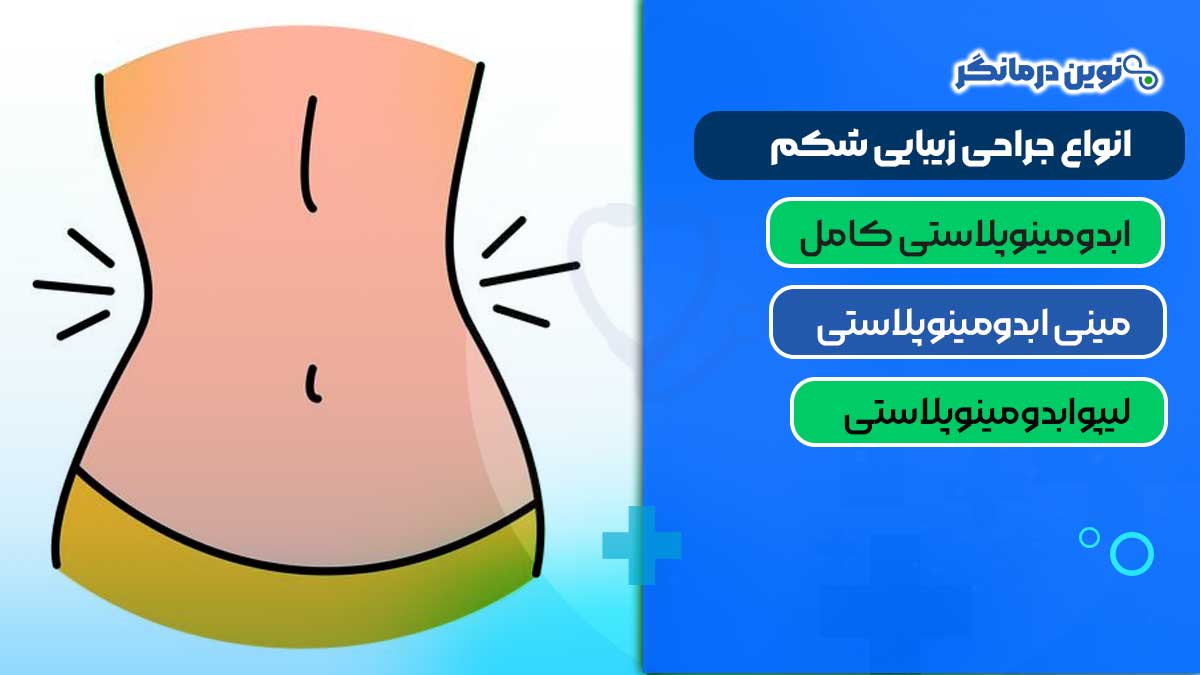 انواع جراحی زیبایی شکم