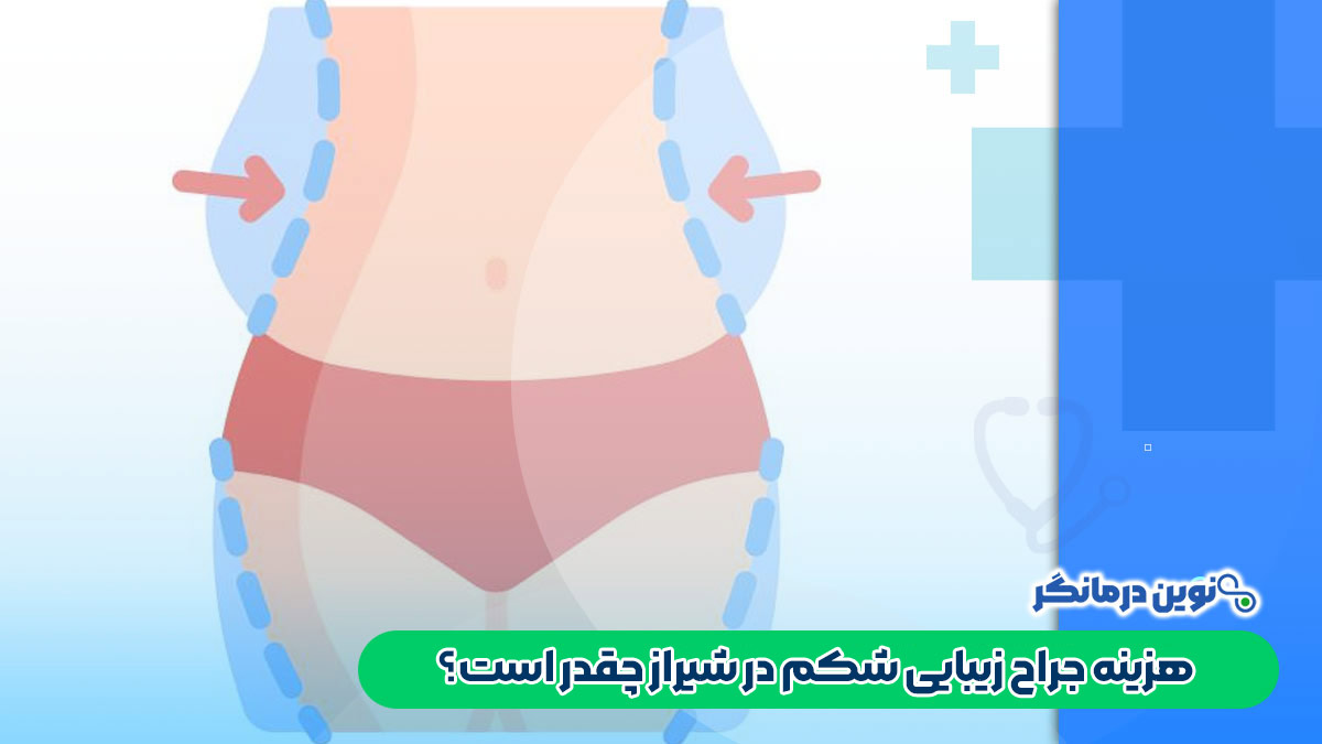 هزینه جراح زیبایی شکم در شیراز چقدر است؟