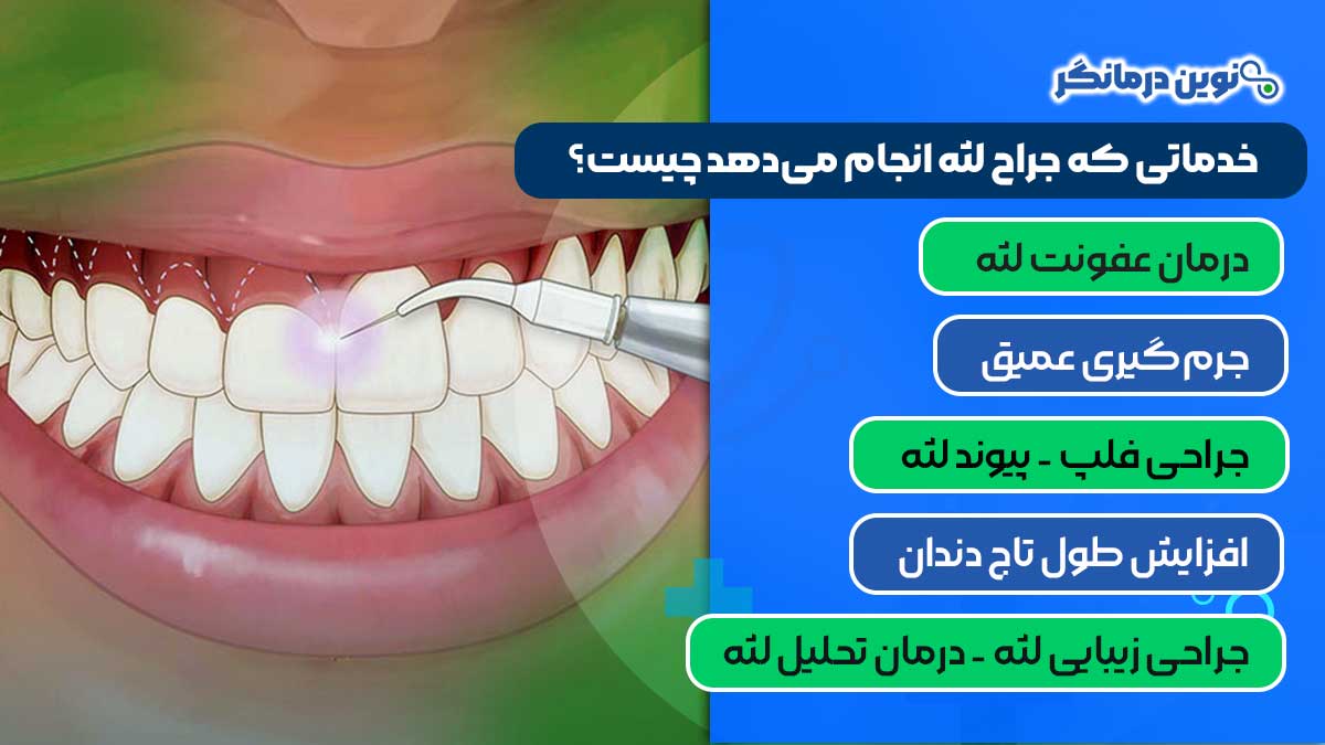 خدماتی که جراح لثه انجام می‌دهد چیست؟
