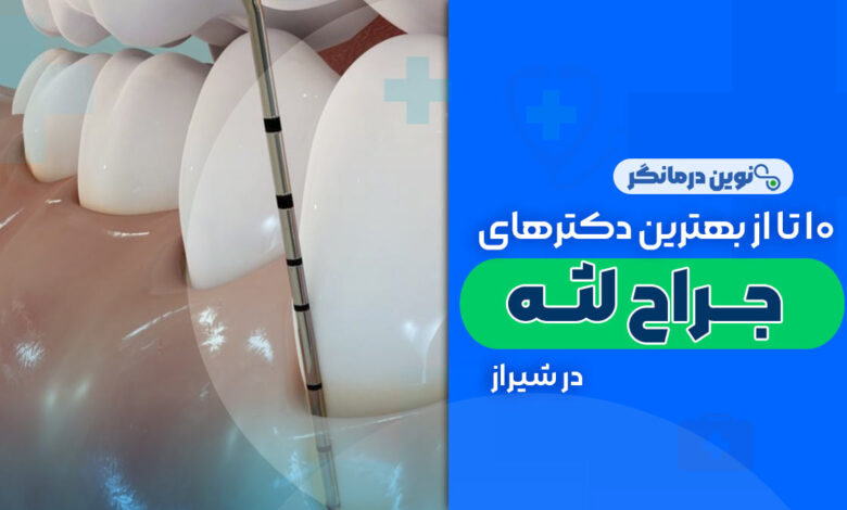 10 تا از بهترین دکترهای جراح لثه در شیراز