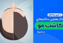 کلینیک های کاشت مو در شیراز