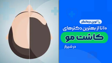 کلینیک های کاشت مو در شیراز